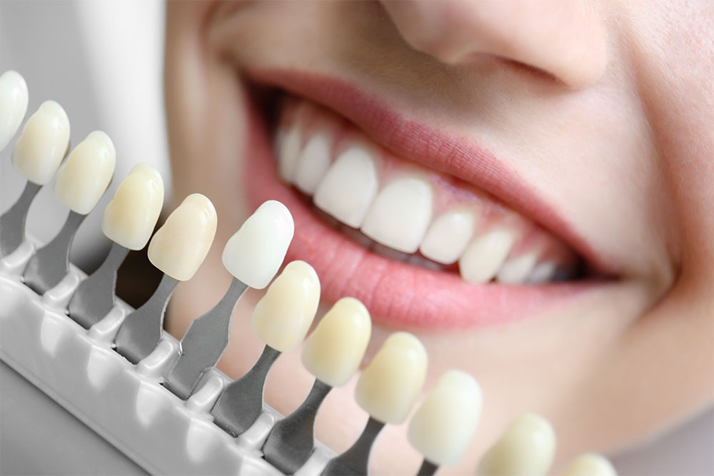 A Guide to Cosmetic Dentistry: Transforming Smiles with Confidence